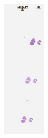 ../_images/_notebooks_01-wsi-reading_42_1.png