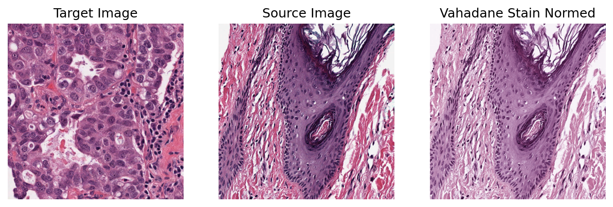 ../_images/_notebooks_02-stain-normalization_21_0.png
