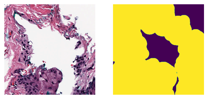 ../_images/_notebooks_03-tissue-masking_28_0.png
