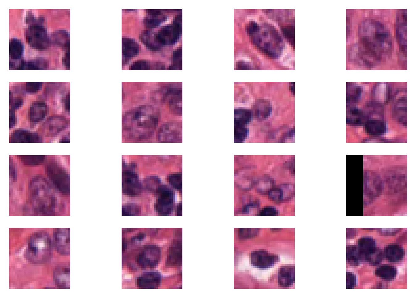 ../_images/_notebooks_04-patch-extraction_19_0.png