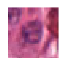 ../_images/_notebooks_04-patch-extraction_21_1.png