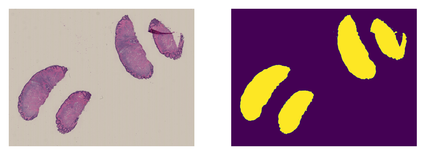 ../_images/_notebooks_06-semantic-segmentation_32_2.png