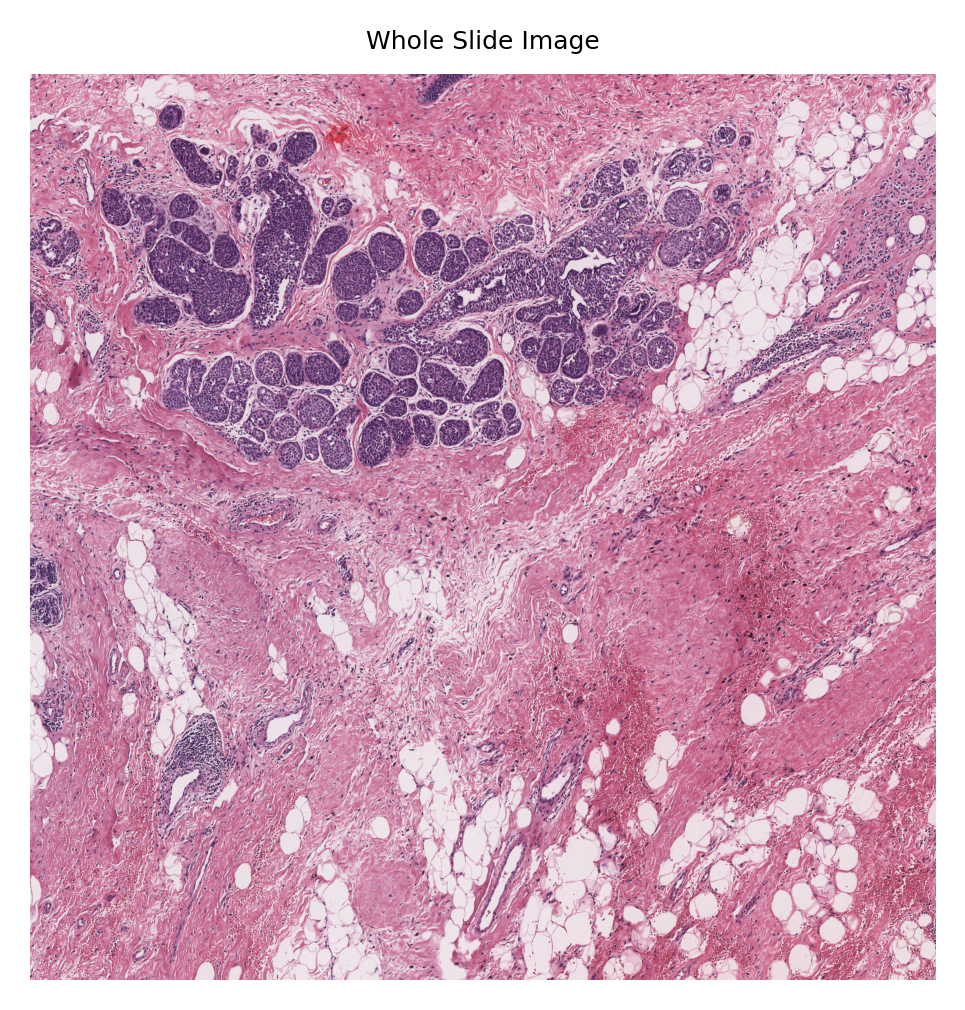 ../_images/_notebooks_08-nucleus-instance-segmentation_26_2.png