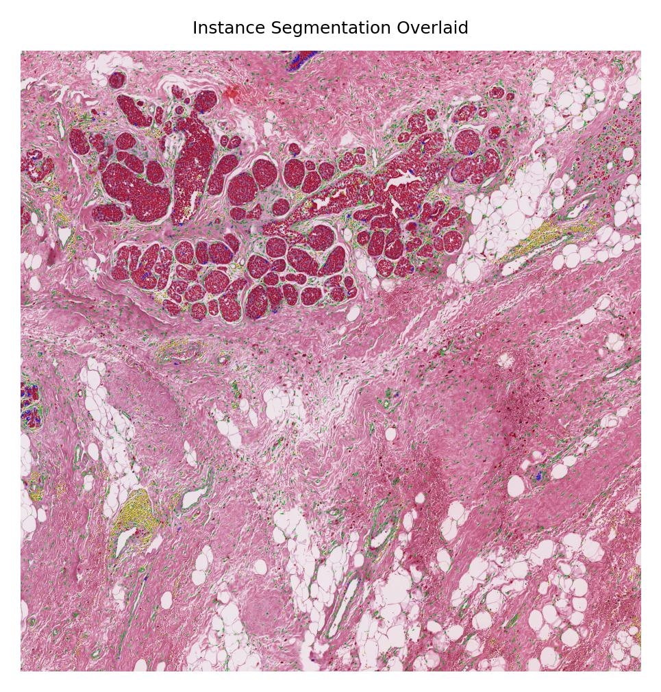 ../_images/_notebooks_08-nucleus-instance-segmentation_26_3.png