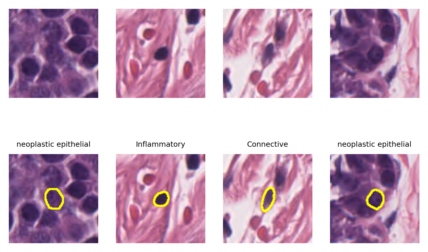 ../_images/_notebooks_08-nucleus-instance-segmentation_28_0.png