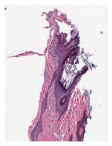 ../_images/_notebooks_02-stain-normalization_13_1.png