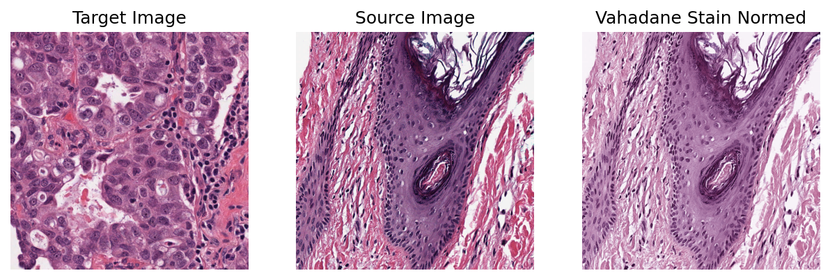 ../_images/_notebooks_02-stain-normalization_21_0.png