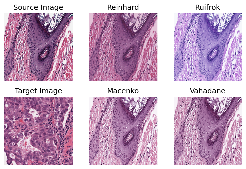 ../_images/_notebooks_02-stain-normalization_24_0.png
