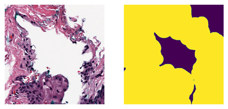 ../_images/_notebooks_03-tissue-masking_28_0.png