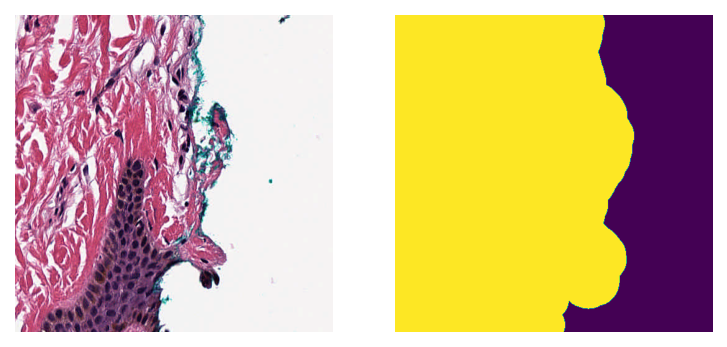 ../_images/_notebooks_03-tissue-masking_28_1.png