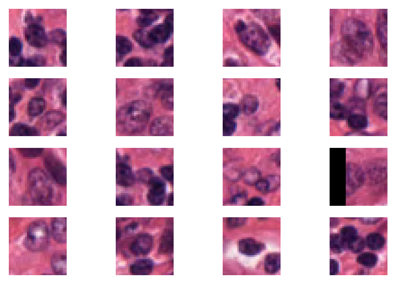 ../_images/_notebooks_04-patch-extraction_19_0.png