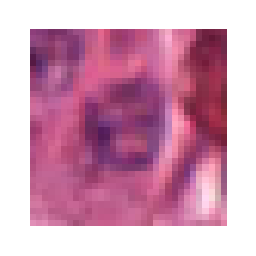 ../_images/_notebooks_04-patch-extraction_21_1.png