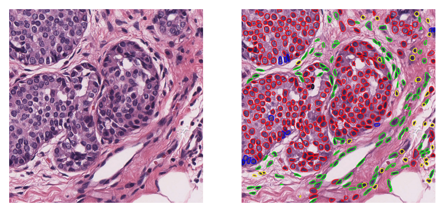 ../_images/_notebooks_08-nucleus-instance-segmentation_19_0.png