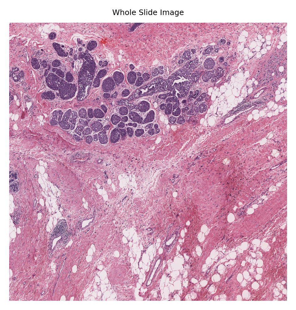 ../_images/_notebooks_08-nucleus-instance-segmentation_26_2.png
