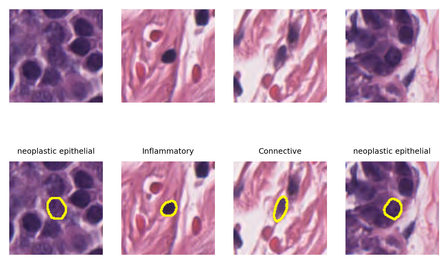 ../_images/_notebooks_08-nucleus-instance-segmentation_28_0.png