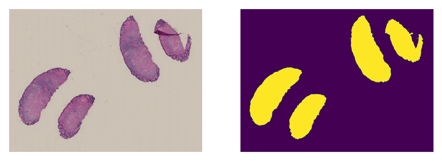 ../_images/_notebooks_06-semantic-segmentation_32_2.png