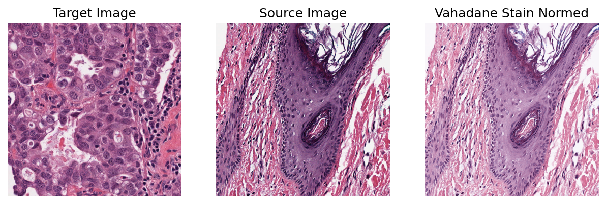 Stain Normalization - TIA Toolbox 2.0.0 Documentation